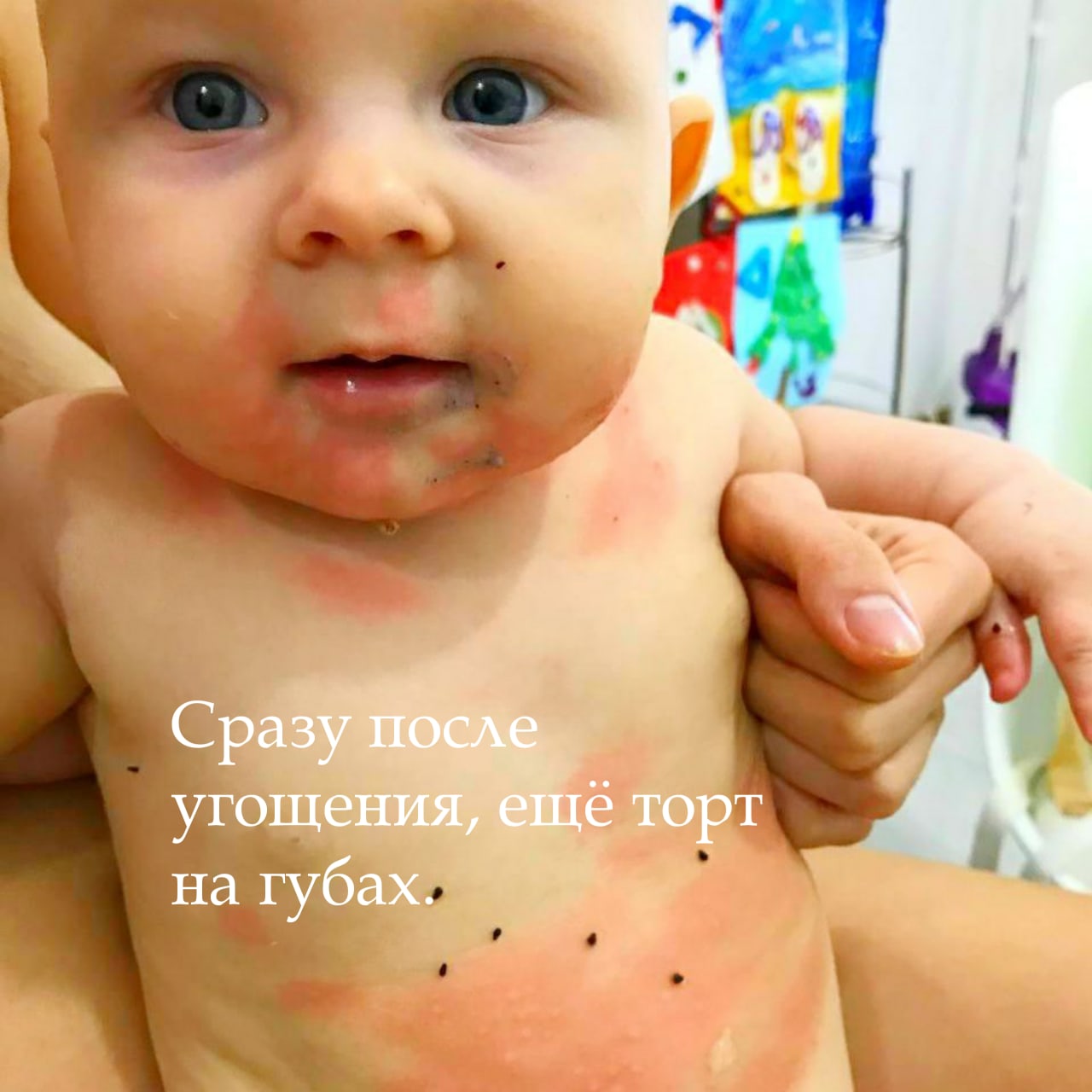 АЛЛЕРГИЯ? СЕРА — ЛУЧШИЙ ПОМОЩНИК! — Княгинюшка