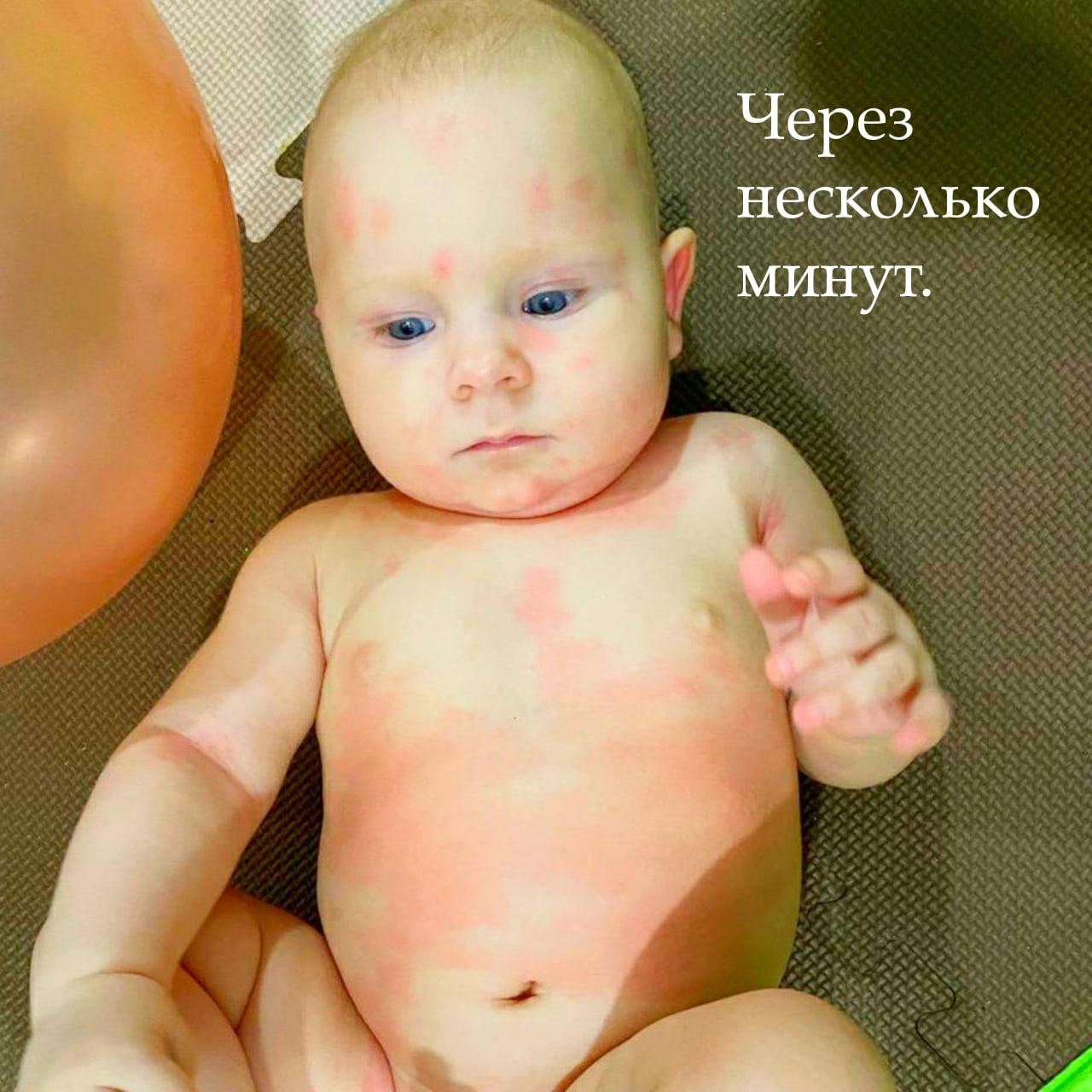 АЛЛЕРГИЯ? СЕРА — ЛУЧШИЙ ПОМОЩНИК! — Княгинюшка